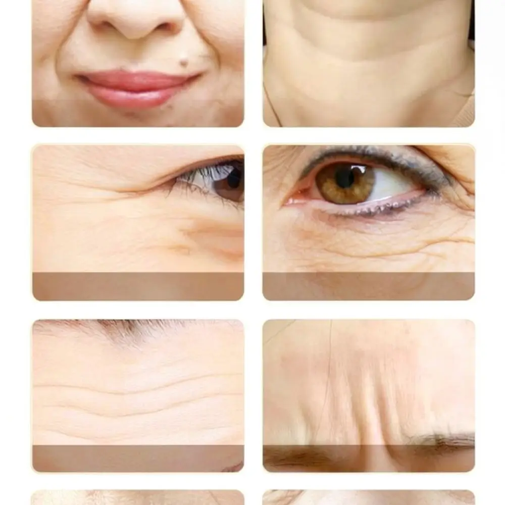 Whitening Cream For Qingliya 377 Dark Spot Remover Face Moisturizer Melasma Treatment Pigmentation Corrector Skin Care