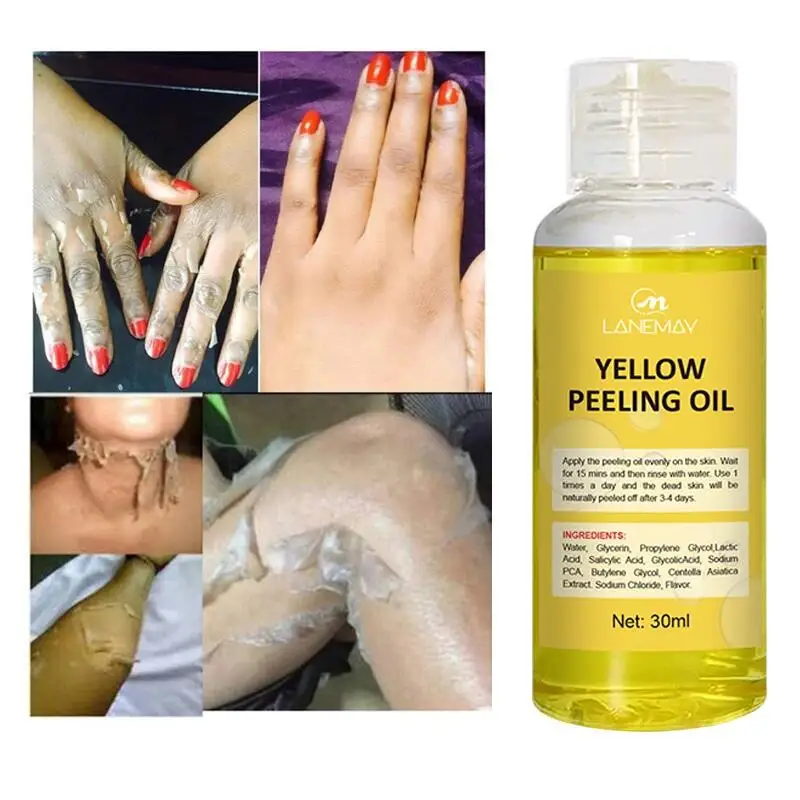 Óleo de peeling amarelo para pele escura, esfoliante, clareamento, manchas, joelho, dedo, remover a pele morta, melanina, clareamento, iluminar o corpo, cuidados com a pele