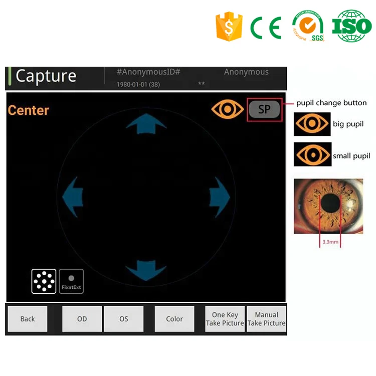 MY-V036B Auto detected the eye position fundus camera digital fundus photography retina camera Price for ophthalmology