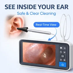 Digital Otoscope with 4.5 Inches Screen 3.9mm Ear Camera with 6 LED Lights 32GB Card Ear Wax Removal Tool Specula and 2500 mAh