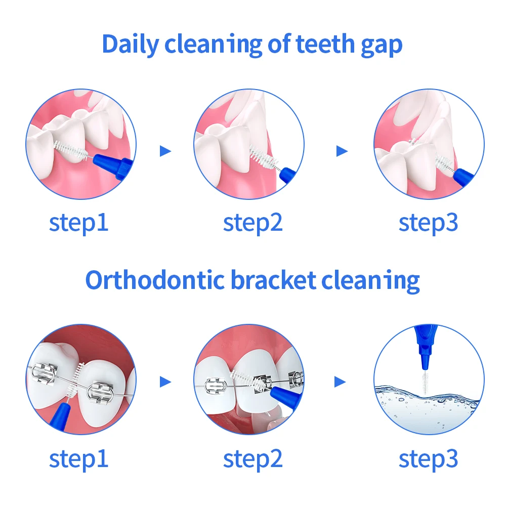 5 قطعة L على شكل فرشاة بين الأسنان المسواك العناية بالفم تقويم الأسنان نظيفة بين الأسنان فرشاة ناعمة بين الأسنان 0.6-1.5 مللي متر #5