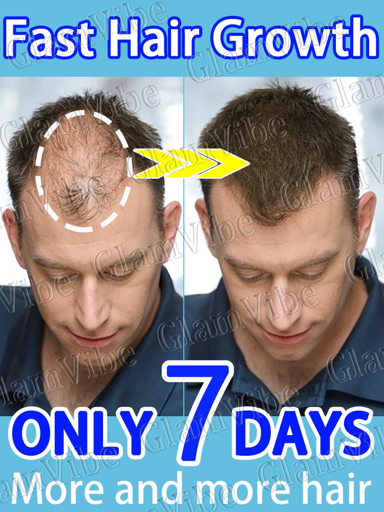 

Освежающая эссенция питает кожу головы, пробуждает фолликулы для волос, восстанавливает поры и делает гуще волосы в день.