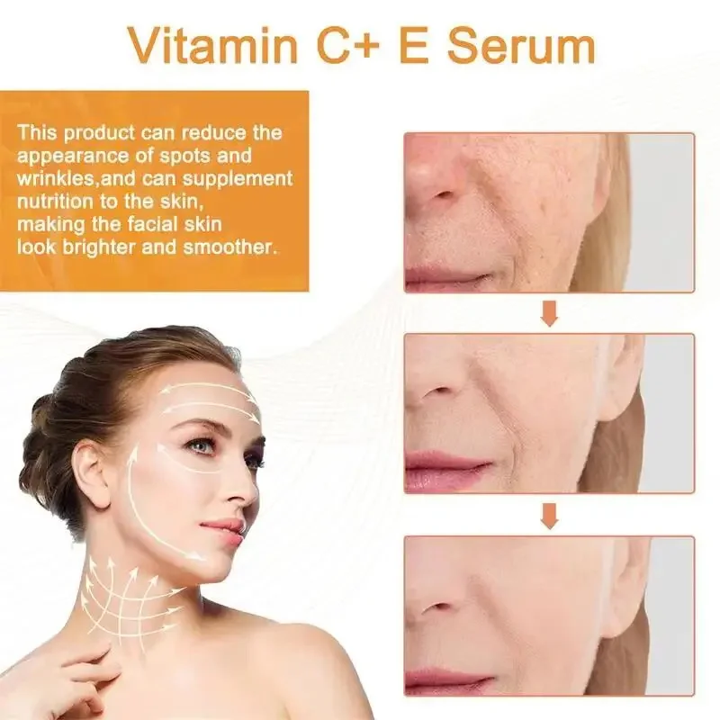 Vitamin C Whitening Serum Remove Freckles Dark Spots Face Essence Fade Melasma Melanin Brighten Repair Dull Skin Care Cosmetics