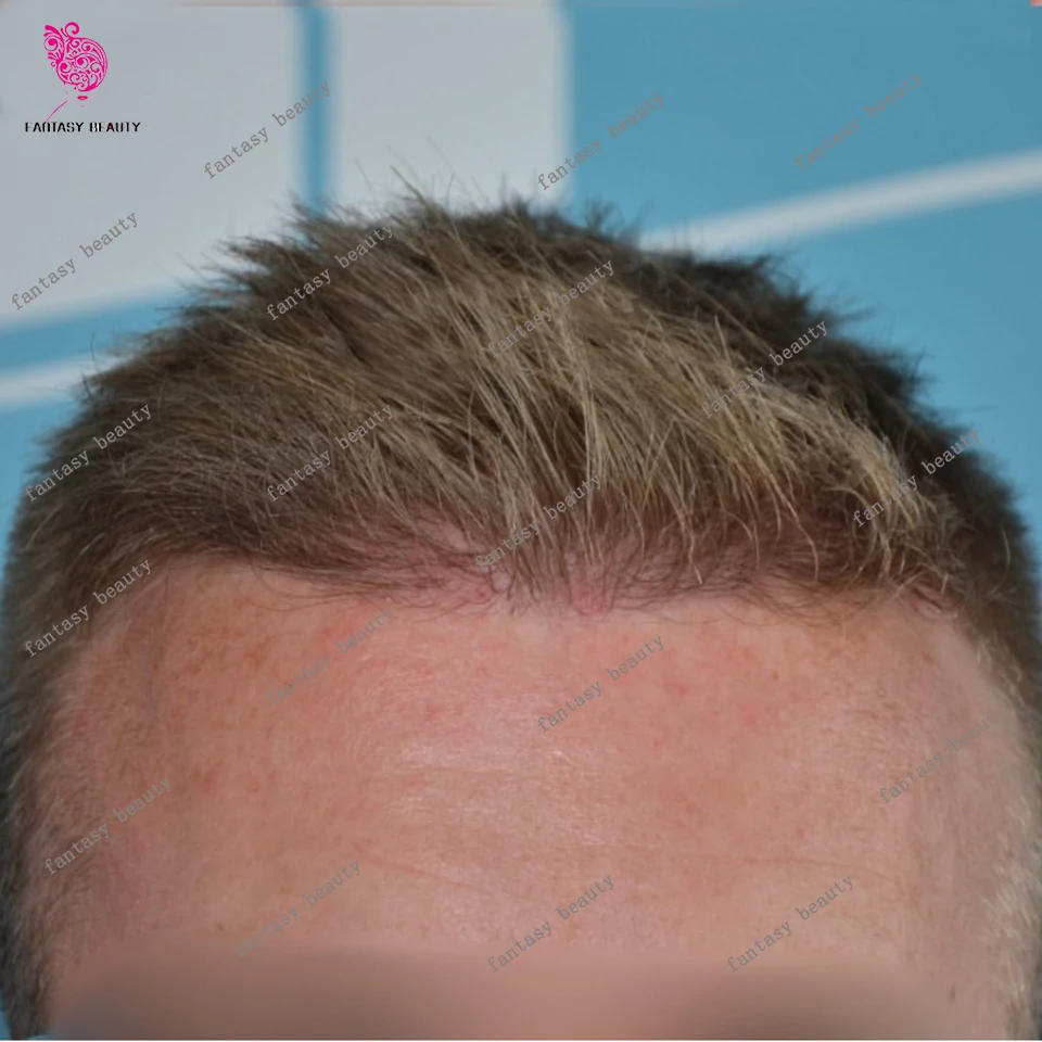 

Light Honey Blonde 22R# 613# 60R# 80%Density 0.02mm Super Thin Skin Grey Mans Wig Undetectable Men's Toupee Capillary Prosthesis