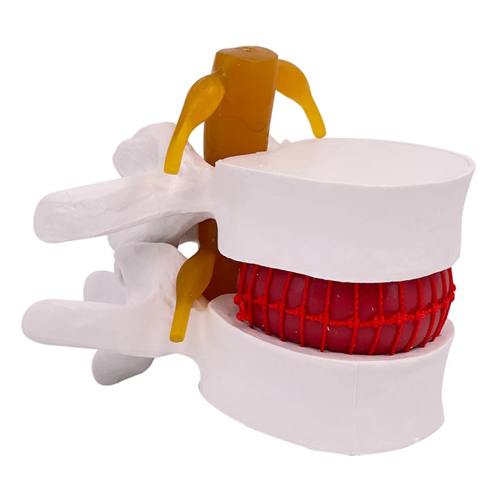 Lumbar Vertebrae Model Durable And Reliable Teaching Aid Wide Application Medical Teaching Tool