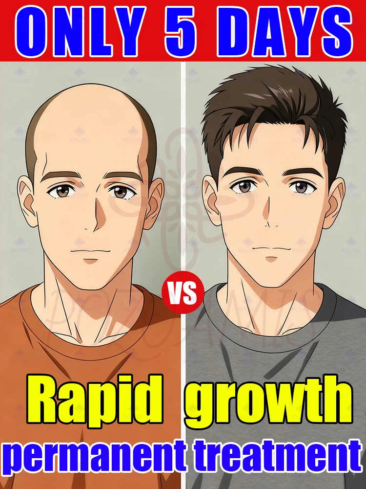 

Top looking sparse Try this "little bottle"