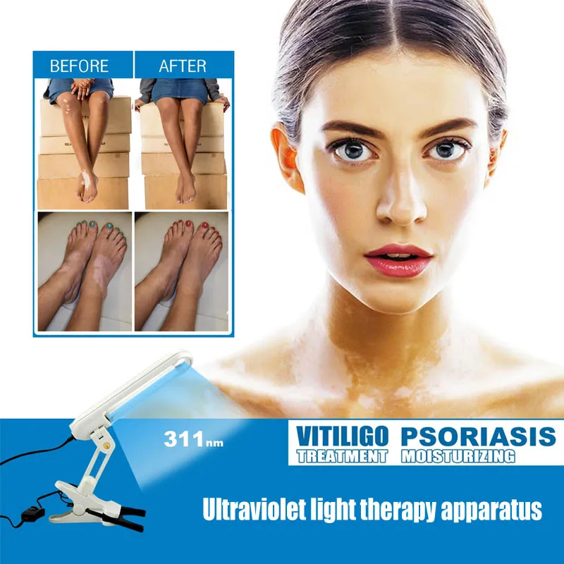 Uvb 311nm Light Therapy For Vitiligo Psoriasis Eczema Dermatitis Skin Problems Treatment Uv Lamp 110V/220V