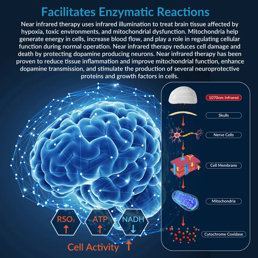 ZJKC 1070nm Parkinsons Brain Stimulation Near Infrared Light Therapy Helmet for Stroke Alzheimer Depression Photobiomodulation