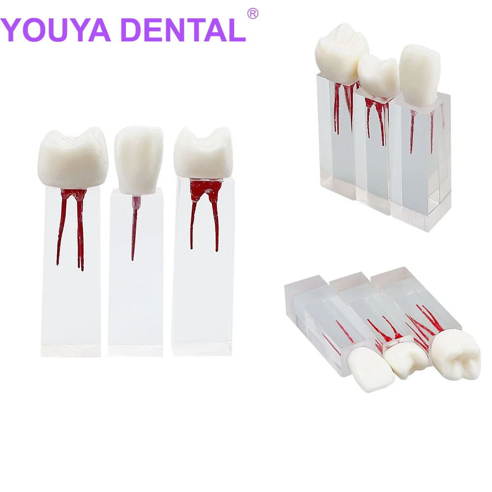 

Dental Teeth Model Endodontic Root Canal Block Practice Model Dentistry Teaching Practice Medullary Pulp Cavity Clear Resin RCT