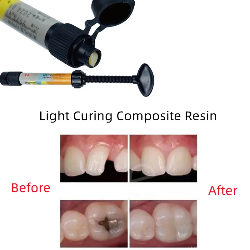 

Dental Light Curing Composite Resin Universal Adhesive Bonding Filling Material A1 A2 A3 2.5g