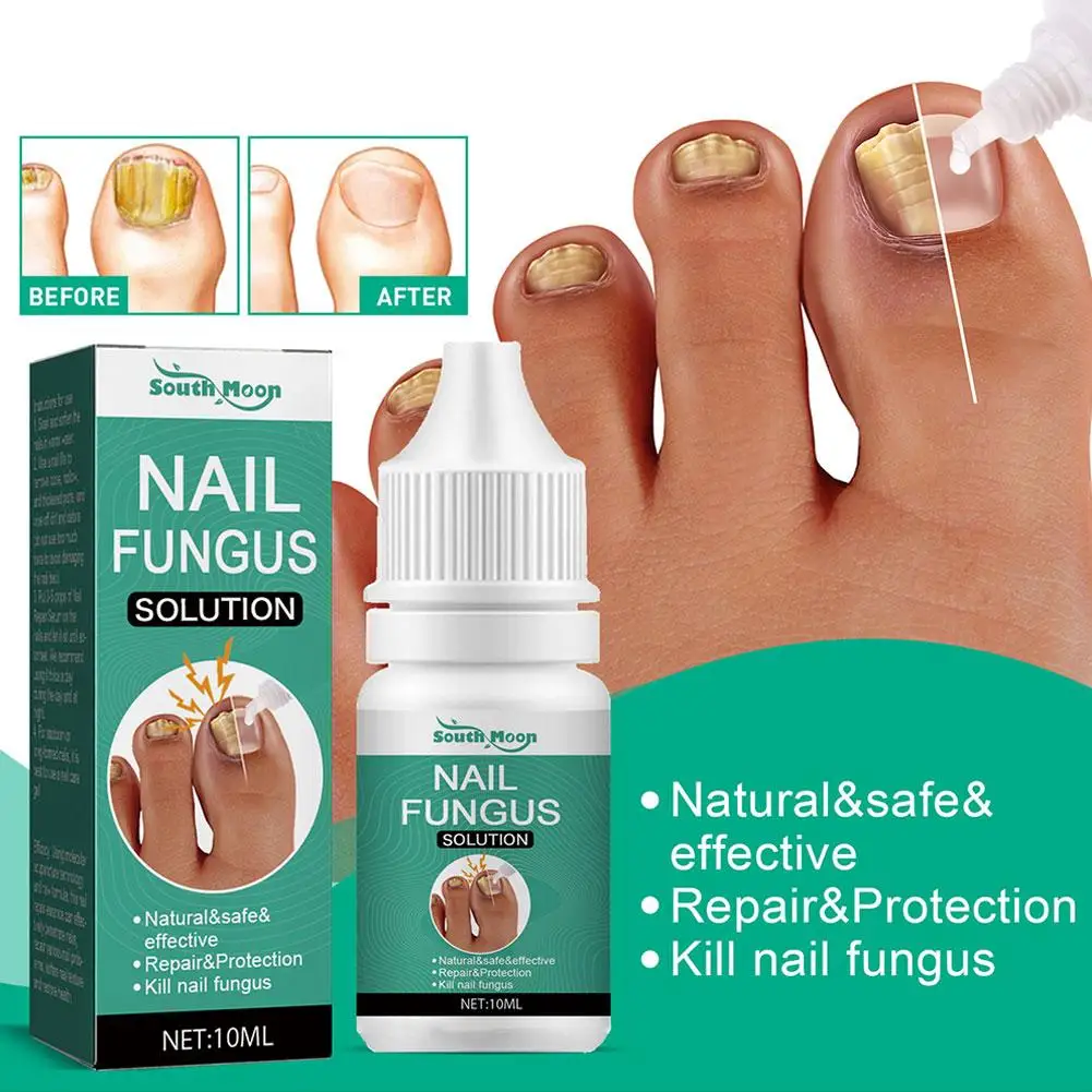 New 10ml Bee Onychomycosis Care Solution Pecial Liquid Nail Nail Brightening Toe Remove Grow Onychomycosis Care Effectively H5d5