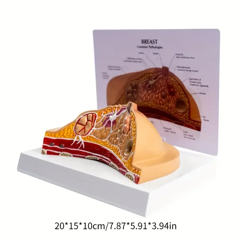 Artificial Human Pathological female Breast Model - Medical Disease & Cancer Anatomical models