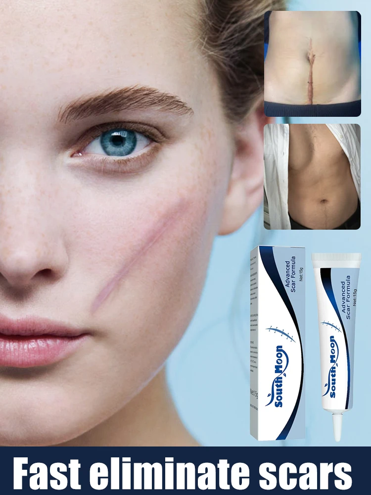 

Scar removal damaged skin scars repair postal operative scar imprint product