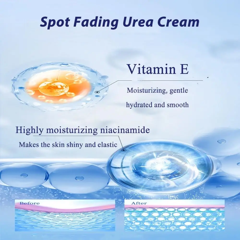 Aufhellende, fleckenverblassende Harnstoffcreme, Sommersprossenentfernung, reduziert dunkle Flecken, Gesichtscreme, reduziert Falten, gleichmäßiger Hautton, Gesichtsfeuchtigkeitscreme