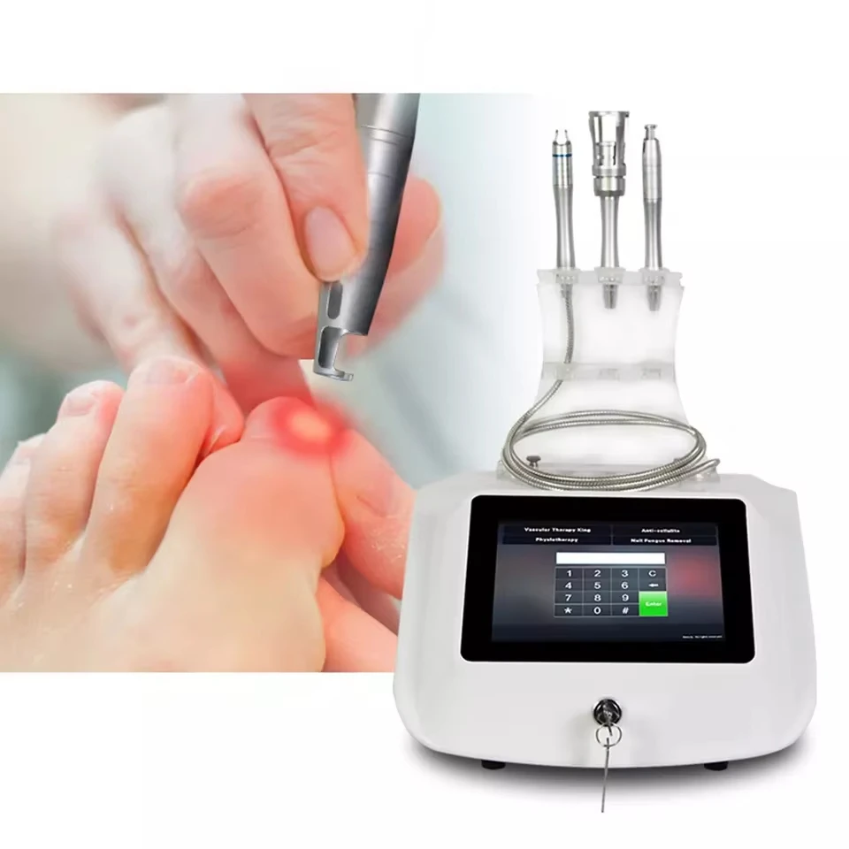 Factory Direct 2026 Removal Vascular Treatment Onychomycosis Toe Nail Fungus Treatment high frequency rf spider vein removal mac
