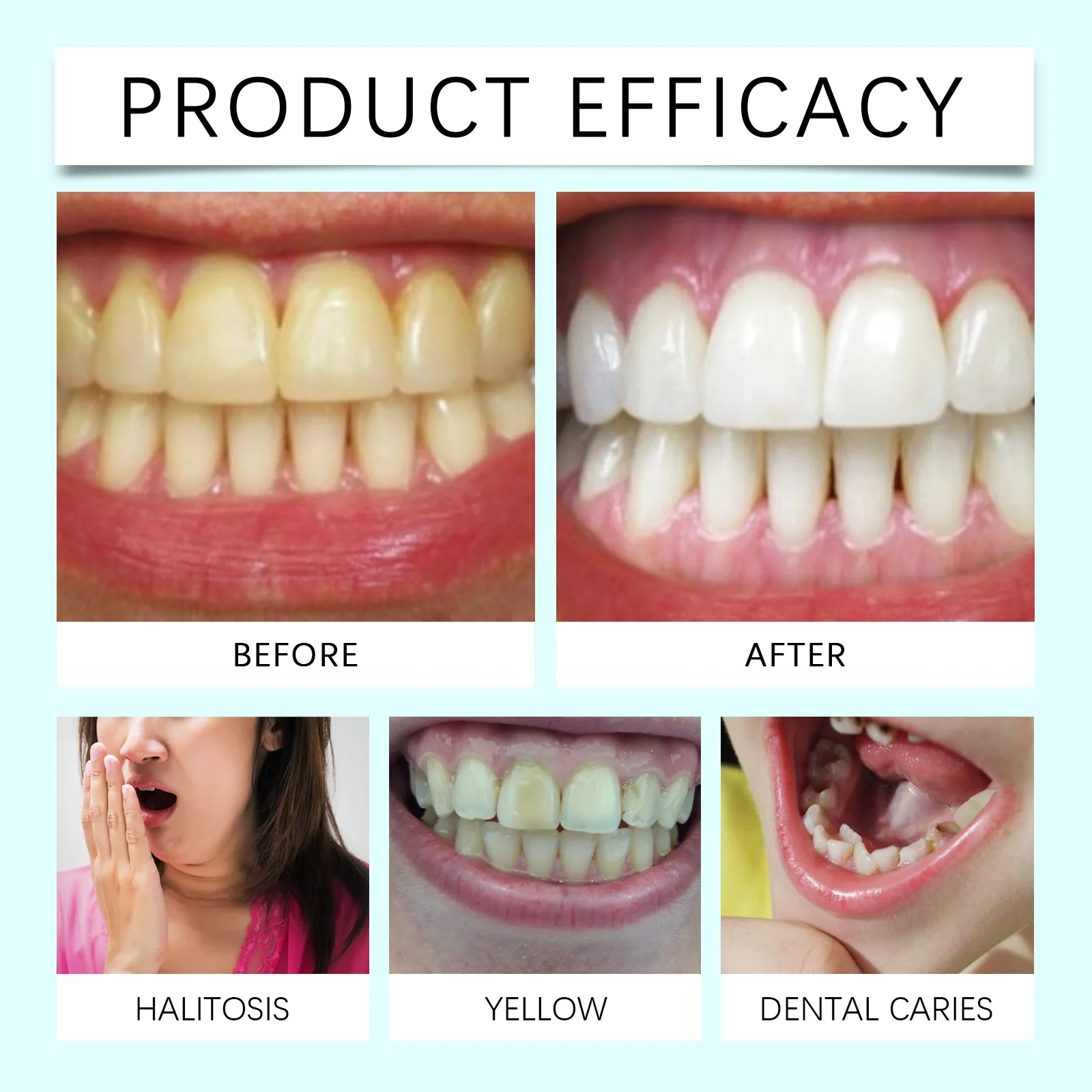 معجون أسنان صودا الخبز بالنعناع يزيل البقع بشكل فعال للأسنان الصفراء ويزيل الرائحة معجون أسنان للعناية بالفم منعش يدوم طويلاً