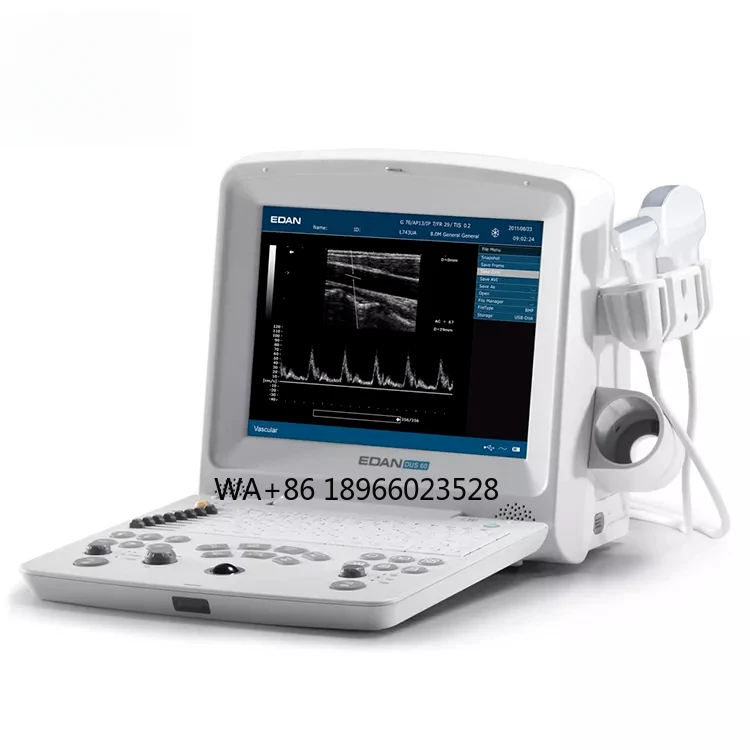 Edan DUS-60 Ultrasound Machine Laptop Edan Ultrasound Portable Ultrasound Machine