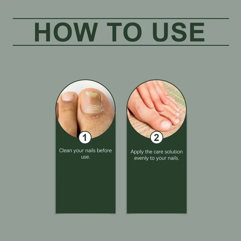60ml Tea Tree Ginger Nail Fungus Care Solution Health Maintenance Repair Discoloration Thickening Hand Foot Nail Treatment E - view 6