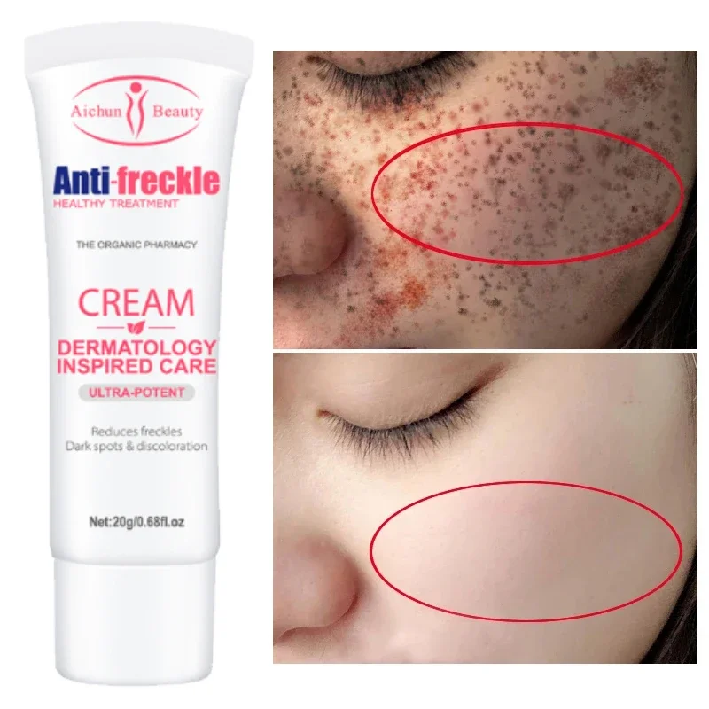 

20g Nicotinamide Face Skin Care Whitening Freckle Cream Oil Control Lifting Firming Shrink Pores Repair Nourishing Smoothing