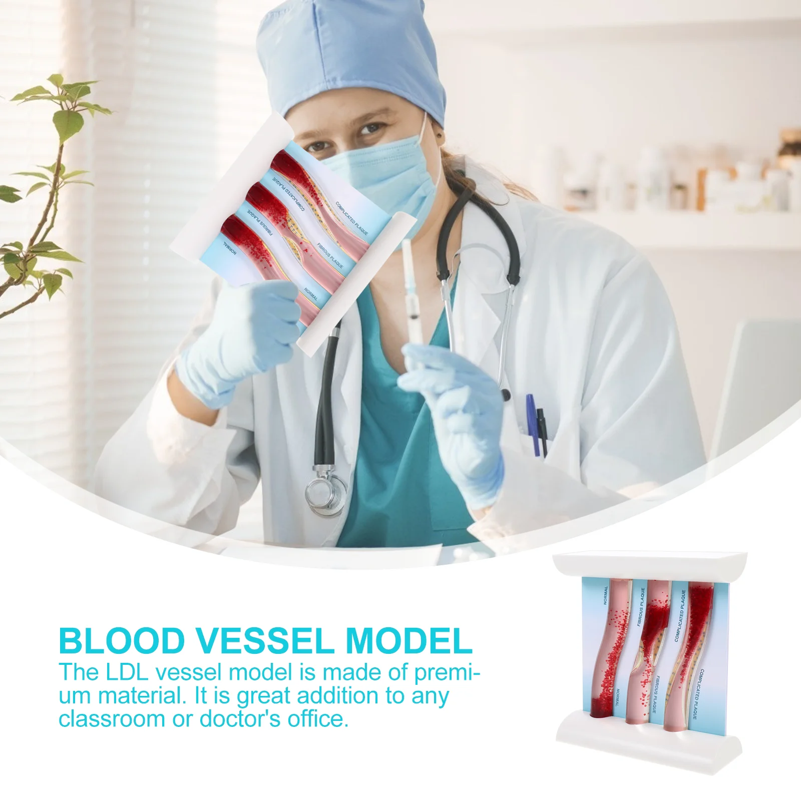 Model Dynamicanatomical Teaching Ldl Vascular Blood Vessel Arteryvein Human Bodylow Density Lipoprotein