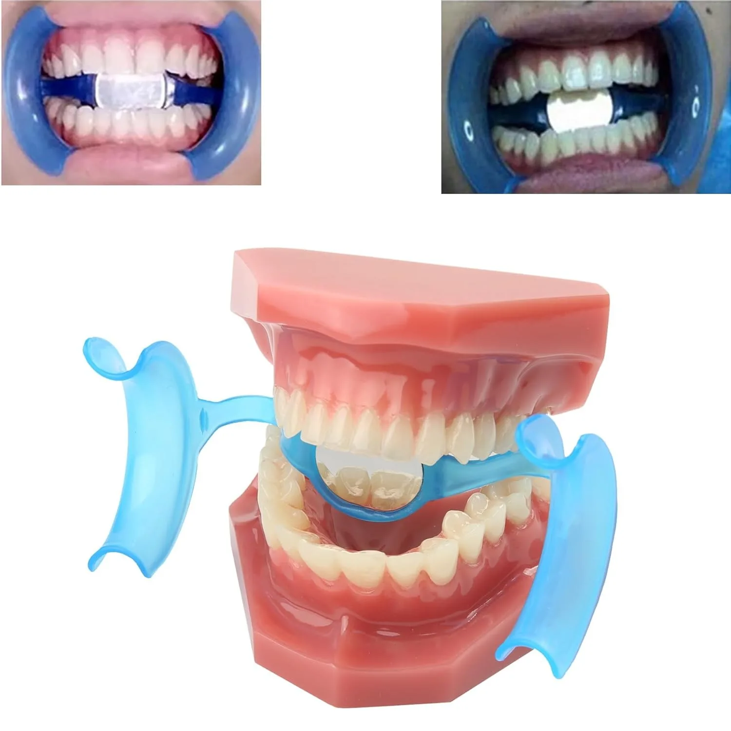 AG 10Pcs Dental Cheek Retractor Mouth Opener M Shape Autoclavable with Mirror for Teeth Whitening Mouthpiece Dentist Tools