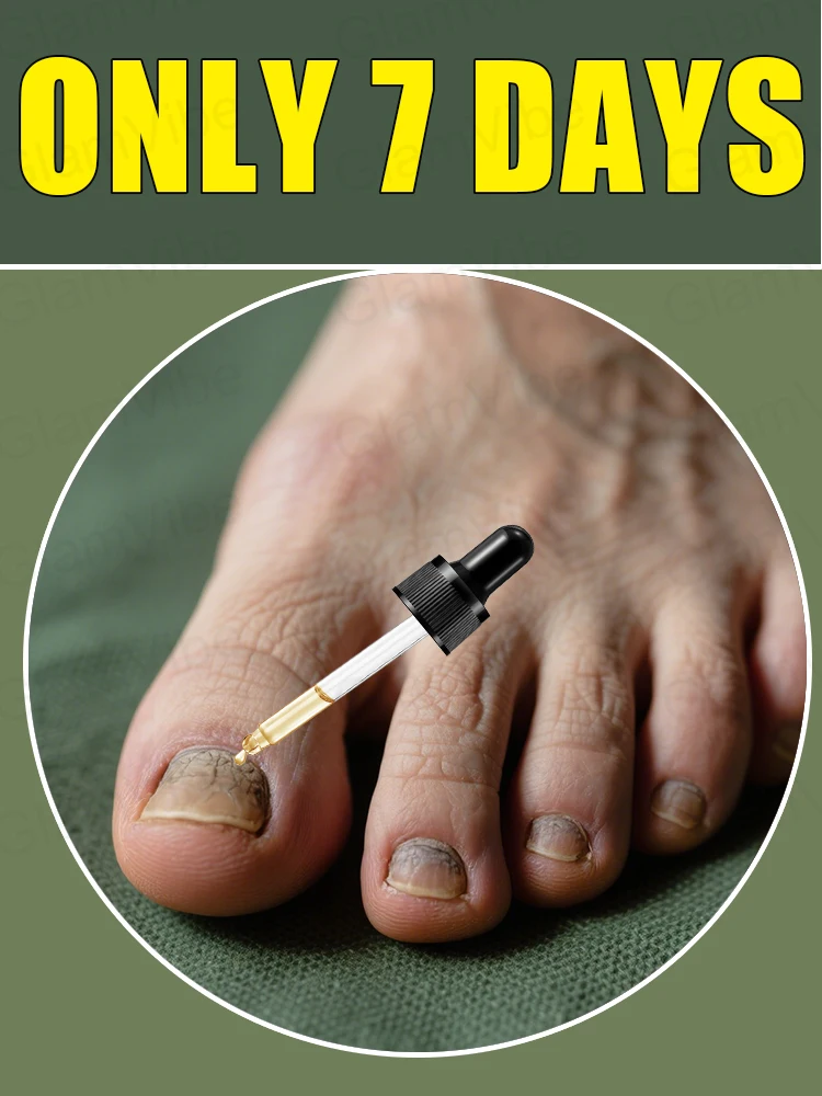 

Nᴇᴡ Oɴʏᴄʜᴏᴍʏᴄᴏsɪs Tʀᴇᴀᴛᴍᴇɴᴛ Pʟᴀɴ, Eᴀsɪʟʏ Rᴇɢᴀɪɴ Hᴇᴀʟᴛʜʏ Nᴀɪʟ Bᴇᴅs