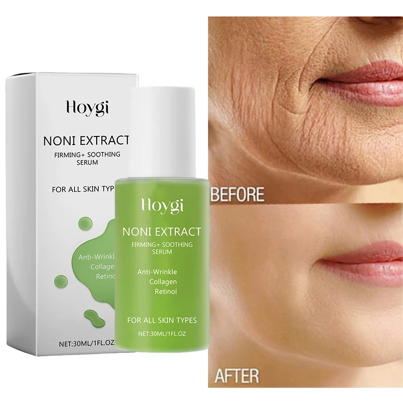 Noni ampolla Retinol suero Facial hidratante antienvejecimiento eliminador de arrugas colágeno levantamiento suero para el cuidado de la cara cosméticos Coreanos 30ml