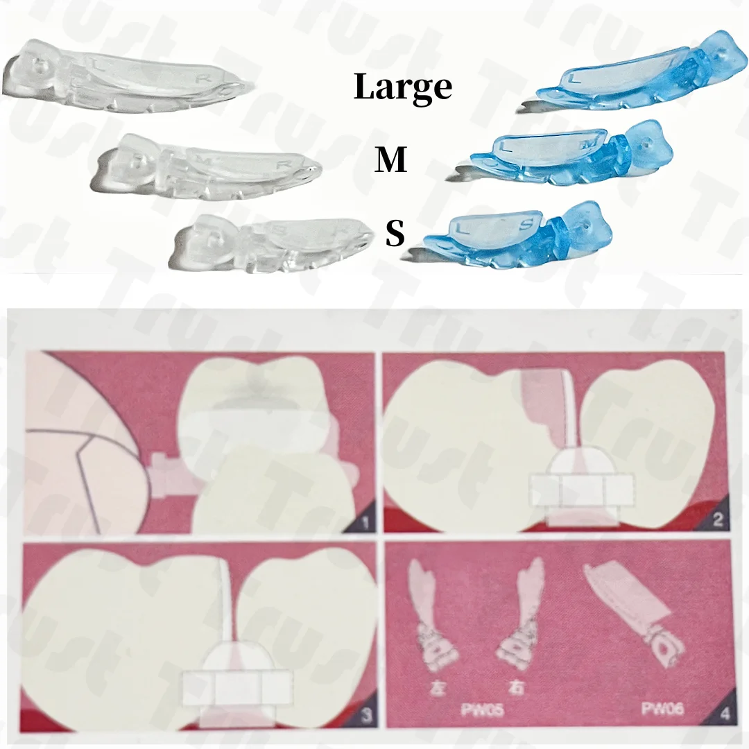 50 Buah Pelindung Pisau Matriks Diastema Interproksimal Wedges Fender Gigi S/M/L