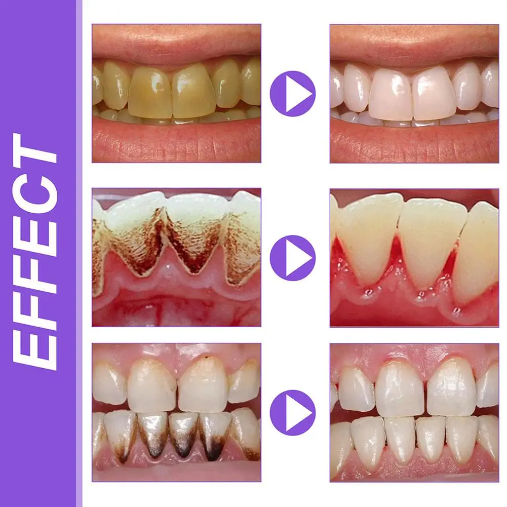 Wybielająca świeży oddech rozjaśniająca fioletowa pasta do zębów usuwa plamę, zmniejsza żółknięcie do zębów dziąsła doustnie 30ml gorącej sprzedaży