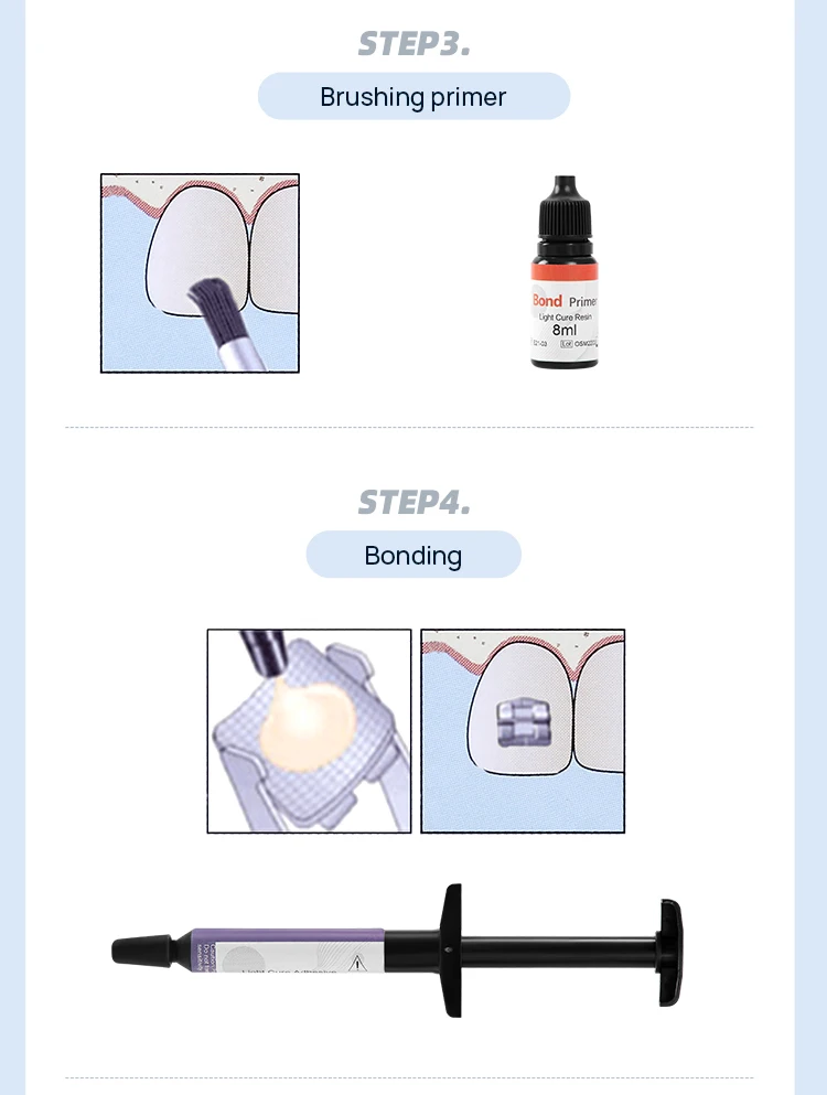 AZDENT Dental Orthodontic Light Cure Adhesive Bonding Brackets Braces Ortho-Bonding Primer Paste Kit Zahnheilkunde – Detail 5