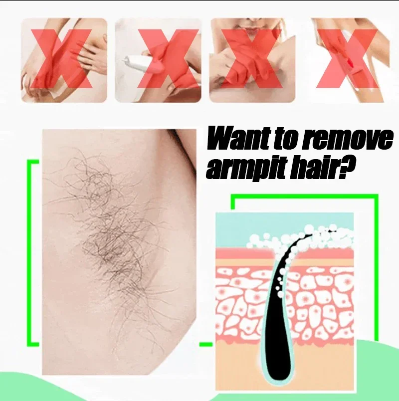 Body Hair Removal Spray Permanent Hair Removal Inhibits Hair Growth Painless Body Care Cream