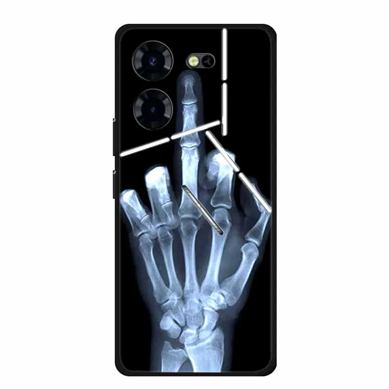 For Tecno Pova 4 5 Case Luxury Soft Silicone TPU Phone Back Cover Case for Tecno Pova 5 4 pro Coque Shockproof Protective Funda