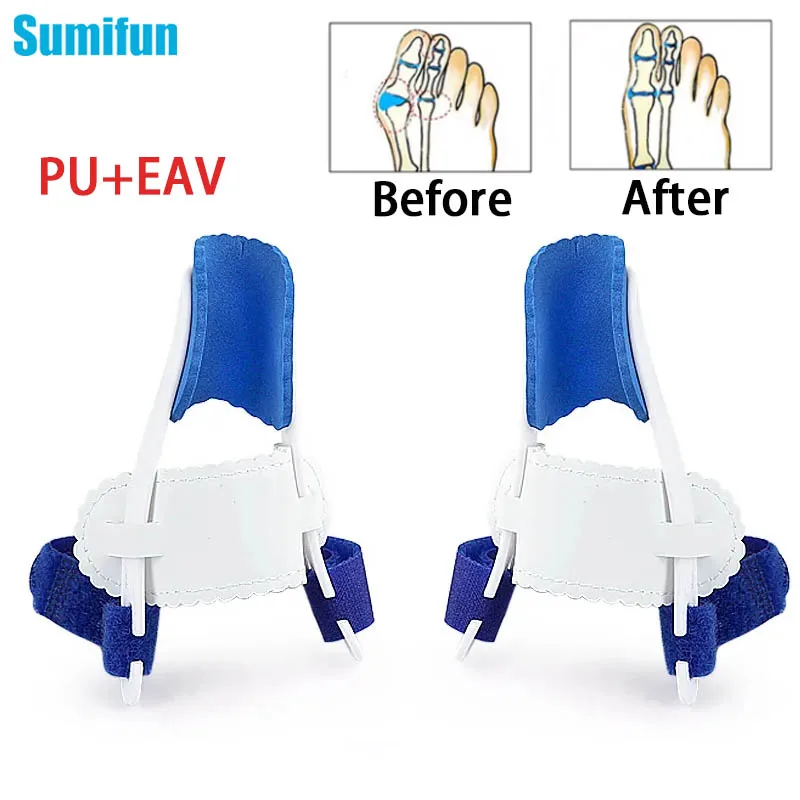 

2Pcs/Pair Orthopedic Bunion Corrector Device Hallux Valgus Toe Correction Pedicure Foot Care Tool Thumb Big Bone Orthotics