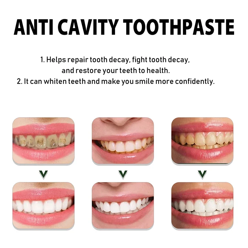 Dental Calculus Remover Natural Plant Extract To Repair Tooth Decay Whiten Teeth Reduce Yellow Remove Cigarette Stains 2024