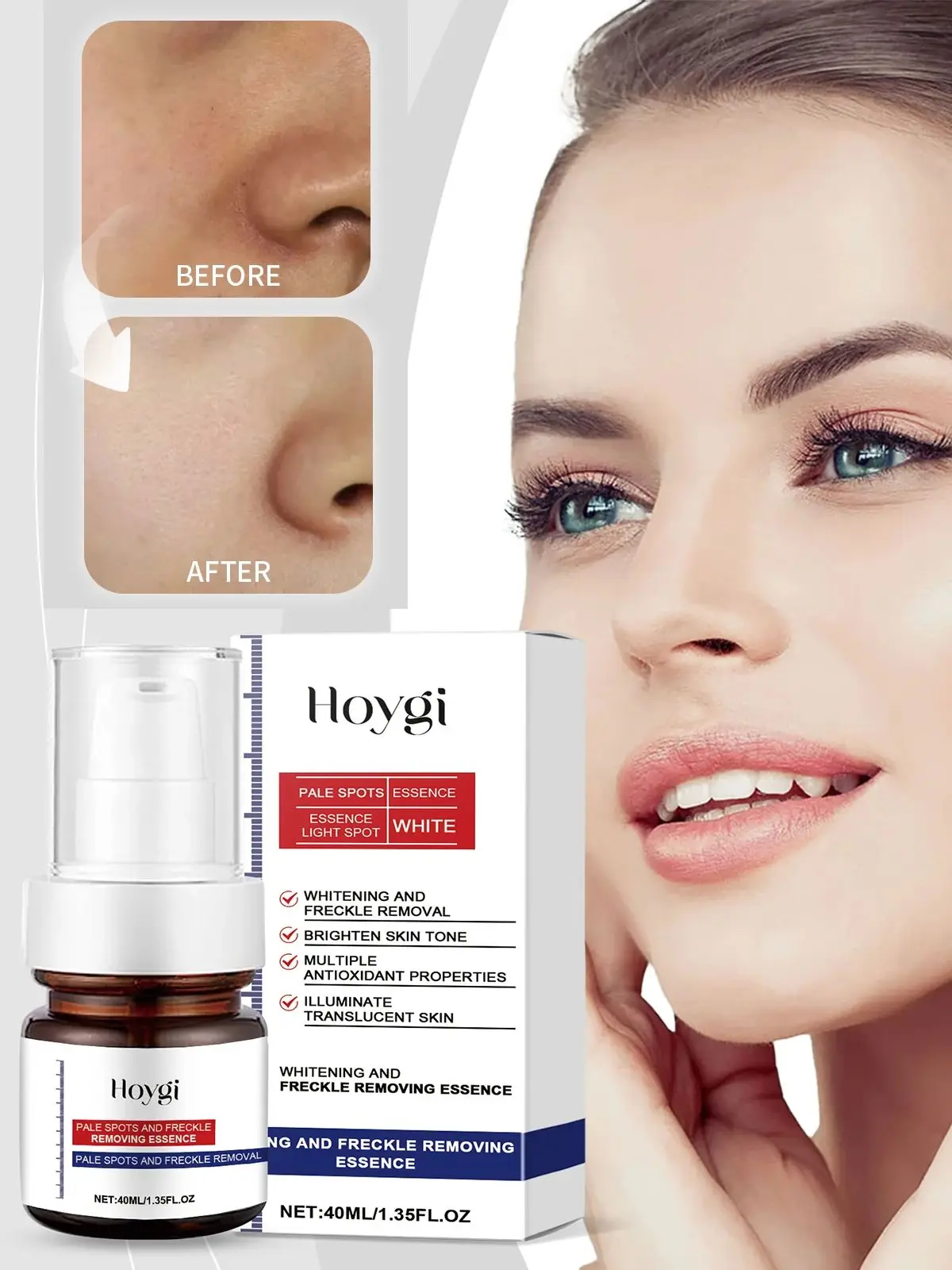 HOYGI – sérum crème à la vitamine C, blanchissant, éclaircissant, teint, éclaircit les taches foncées, réparation du mélasma, hydratant, absorption rapide, soins pour la peau