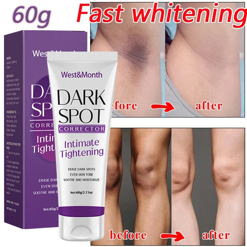 Effective Lighten Thigh Inner Bleach Remove Melanin Private Parts Brighten Cream Nicotinamide Brightening Cream For Dark Skin