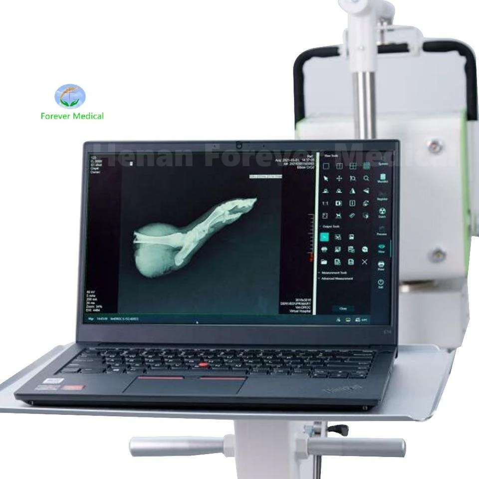 Mesin sinar x Portabel medis troli peralatan sinar x hewan Digital DR Dokter Hewan mesin fluorofil sinar x dengan layar sentuh