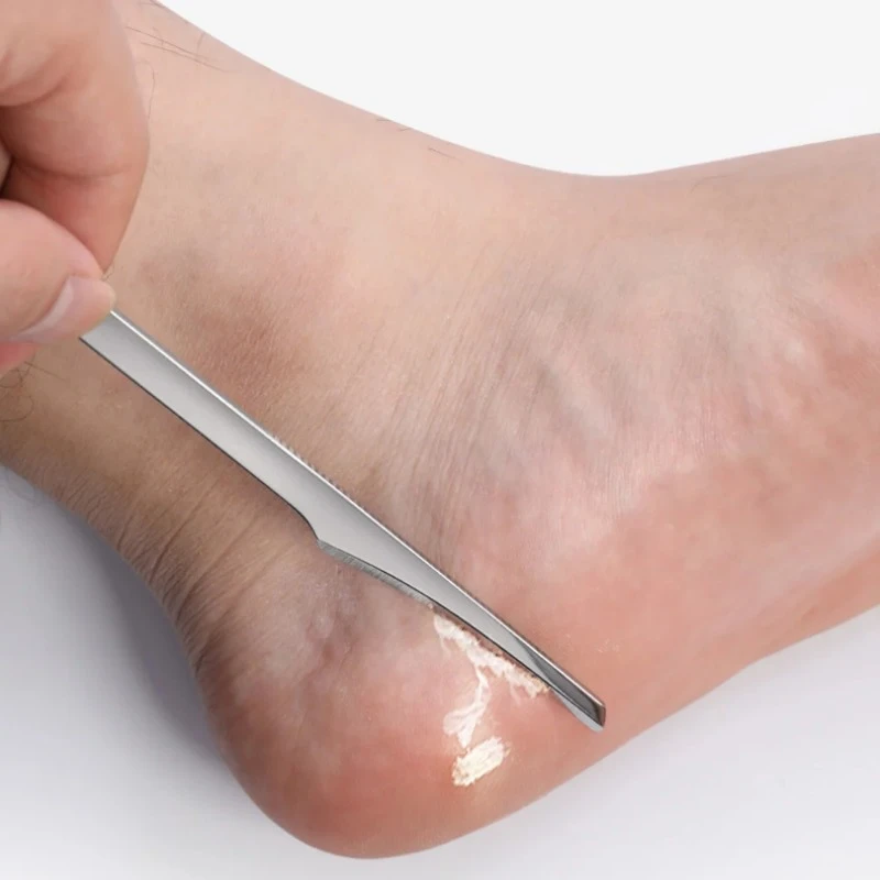 Outils de couteau de pédicure pour les pieds, épurateur de pieds en acier inoxydable, dissolvant de peau de fréquence, grattoir à pied, couteau à gratter, outil de manucure