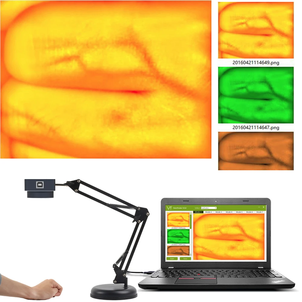 Vein Finder Viewer Display Imaging  Vein Finder for Adult Children Hands Feet Legs Vein