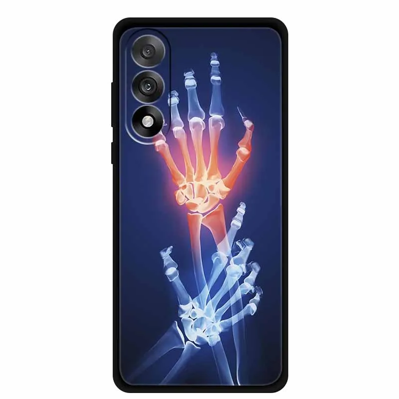 Untuk OnePlus Ace 5 Ultra 5G 2025 Casing Ponsel 6.83" Lukisan Bunga TPU Lembut Penutup Belakang Silikon Hitam Untuk OnePlus Nord 5 5G Fundas