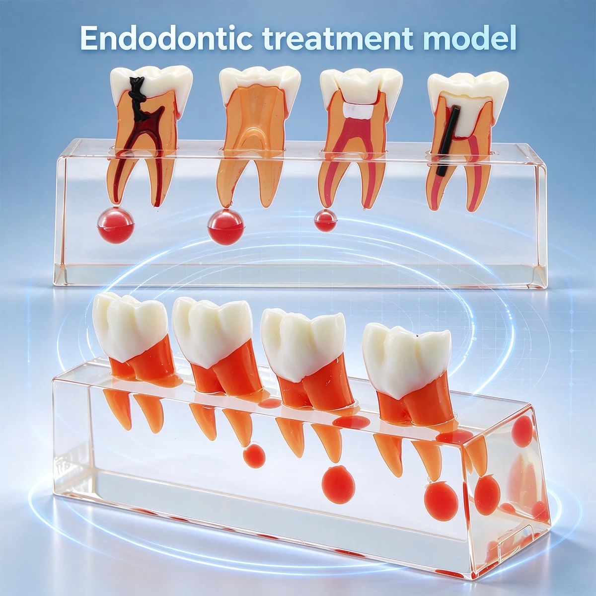 Dental Teaching Model Dentistry Endodontic Treatment Model For Doctor Patient Communication Root Canal Anatomy Clear Study Demo