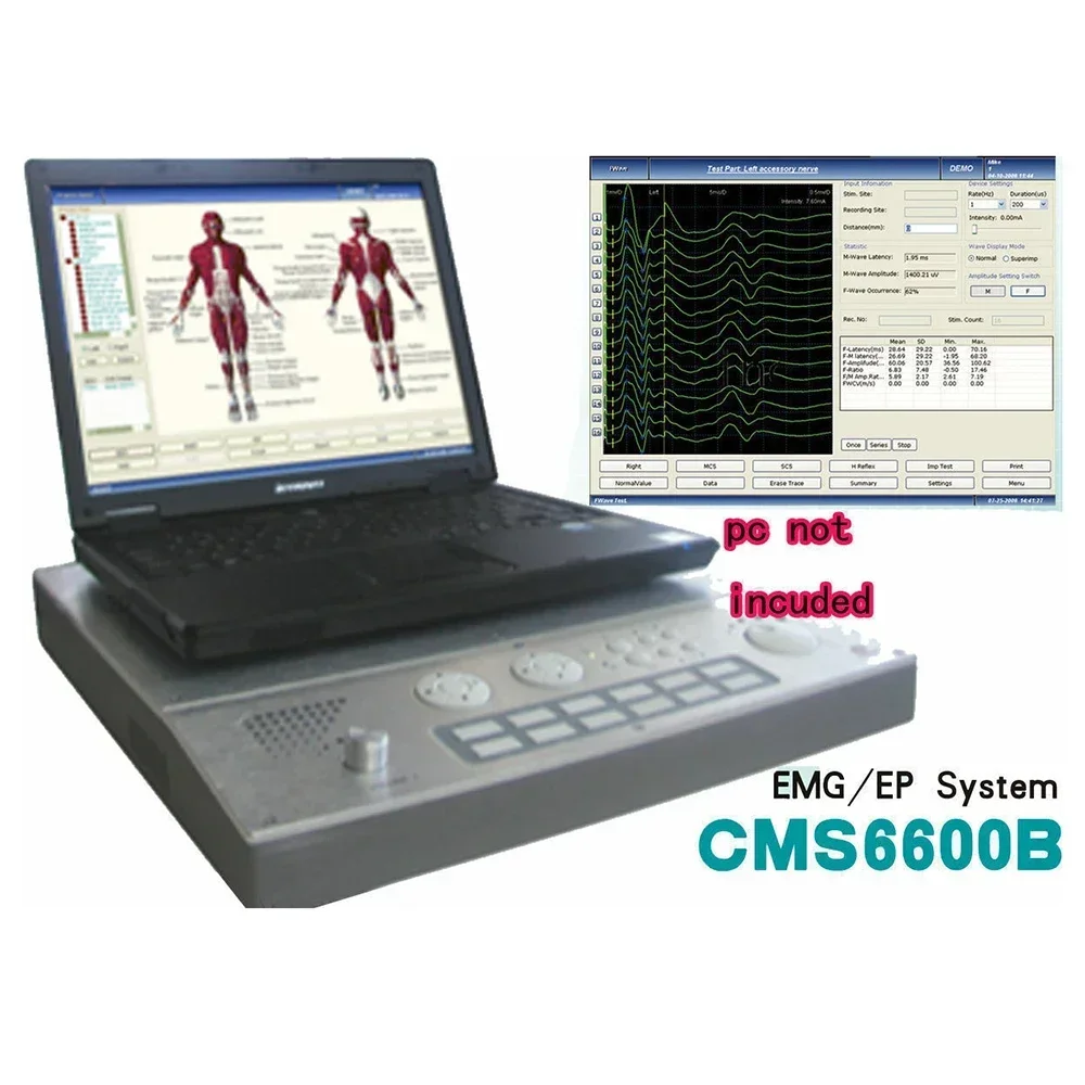 CMS6600B Macchina EMG portatile Monitoraggio Sistema EP Basato su PC Bioelettricità muscolare nervosa a 4 canali Elettromografo evocato