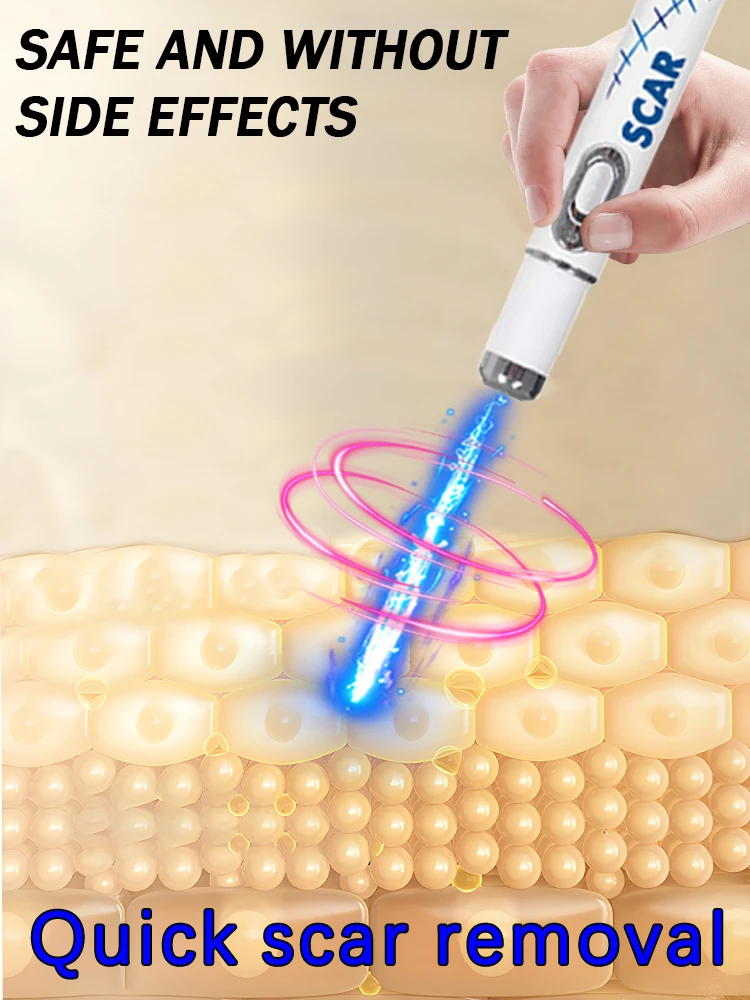 De nieuwste littekenverwijderingstechnologie, littekens binnen 7 dagen verwijderen, best verkocht product in Azië