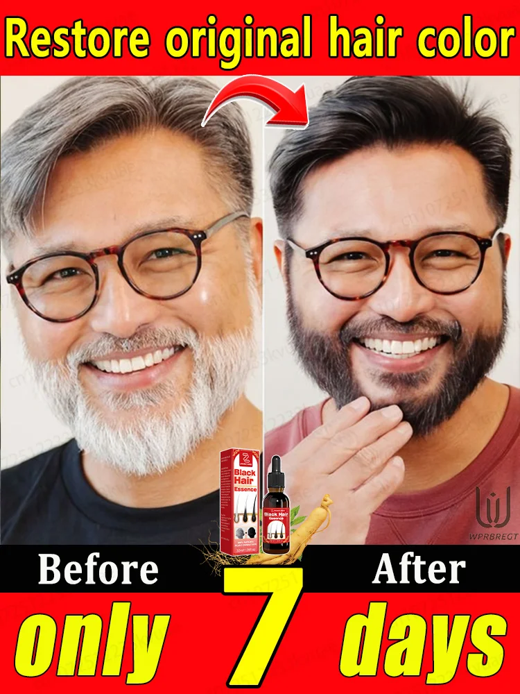 

Сыворотка для восстановления волос — экстракт имбиря премиум-класса для уменьшения седых волос и питательных фолликул для волос.