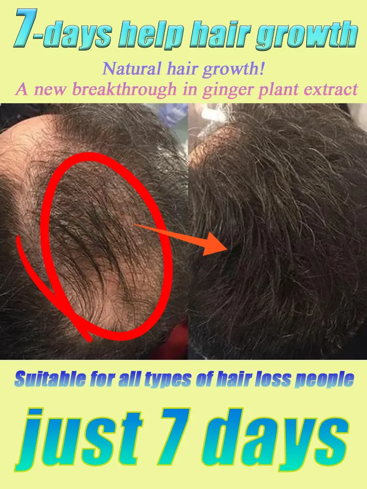 

У вас есть проблемы с выпадением волос Спрей для роста волос, делающий волосы более густыми.