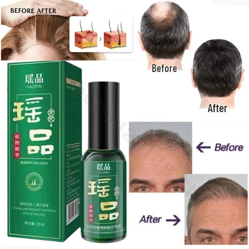 Fast Hair Growth Oil Hair Regeneration Essence Thinning Treatment Growth Fluid Anti-Hair Loss Care for Men and Women