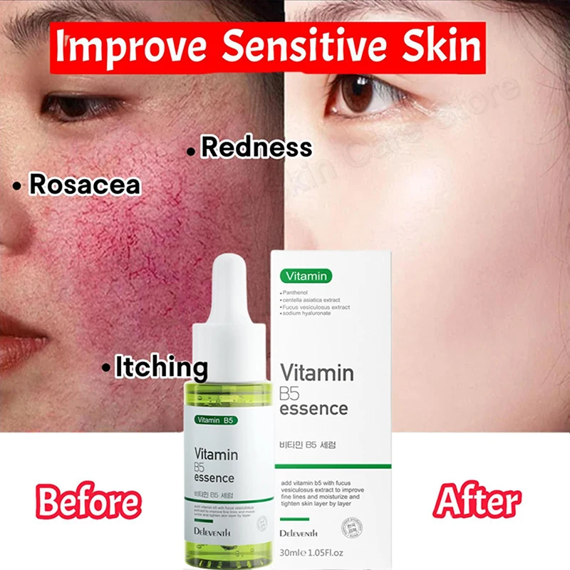 

Facial Redness Repair Serum Improve Sensitive Skin Dryness Moisturizer Hydrating Sooth Lotion Removal Rosacea Korean Cosmetics