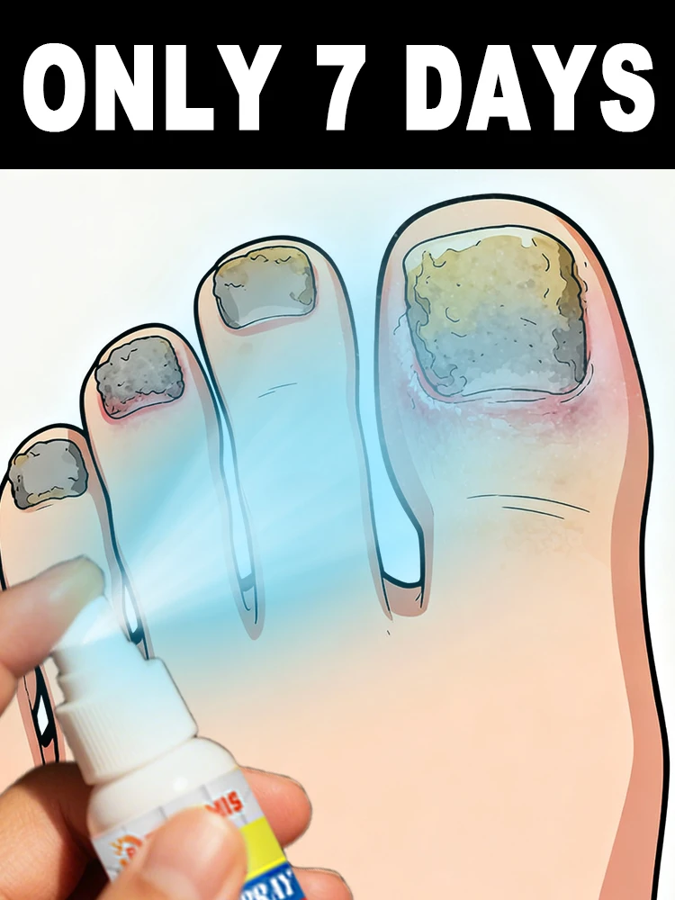 ᔆᵖʳᵃʸⁱⁿᵍ ⁱᵗ ᵒⁿ ⁿᵃⁱˡ ᶠᵘⁿᵍᵘˢ ᵈᵃⁱˡʸ ᶜᵃⁿ ⁿᵒᵗ ᵒⁿˡʸ ᶜˡᵉᵃⁿ the fungus