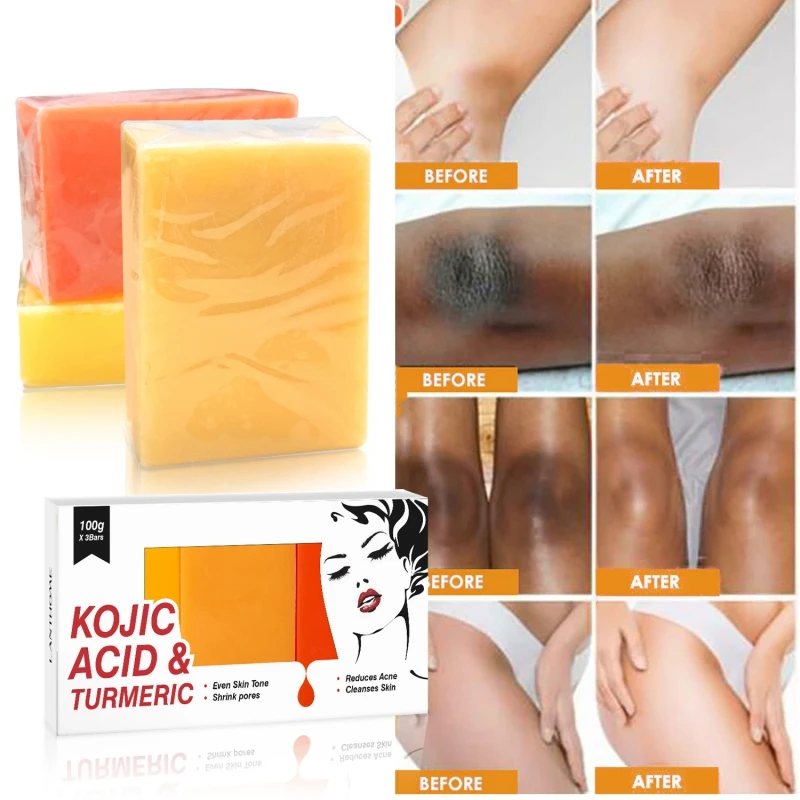 100g X 3Pcs Kojic Acid Turmeric Body Soap Cleansing Melanin Whitening Moisturizing Beauty Health Dark Spot Brighten Skin Tone