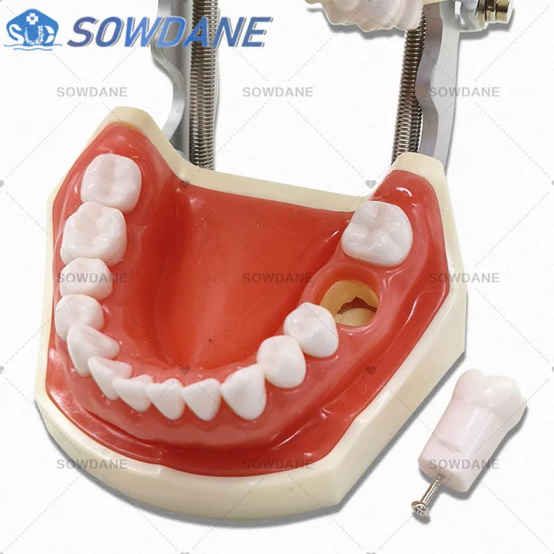 Normal Type Model Dental Universal Plate Type Removable Teeth  Soft Gum Study Tooth Model for New Dentist Traning in school